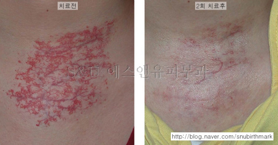 나이에 대한 고찰-마포공덕 에스앤유피부과1.jpg