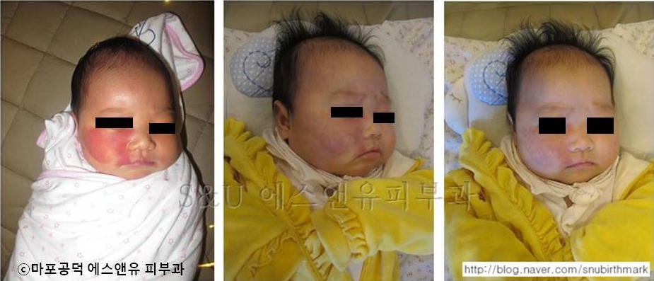 나이에 대한 고찰-마포공덕 에스앤유피부과.jpg